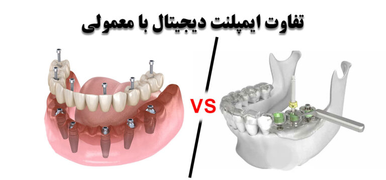تفاوت جراحی دیجیتال و سنتی