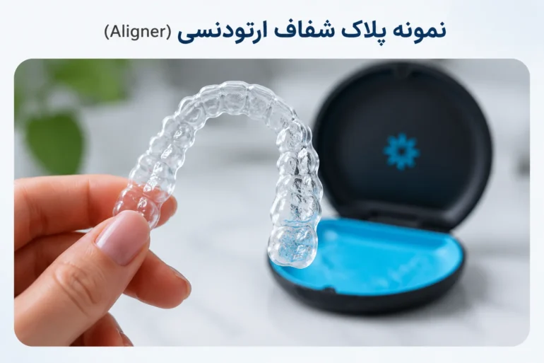 پلاک شفاف ارتودنسی برای مرتب کردن دندان‌ها
