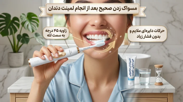 روش صحیح نگه داری از لمینیت دندان