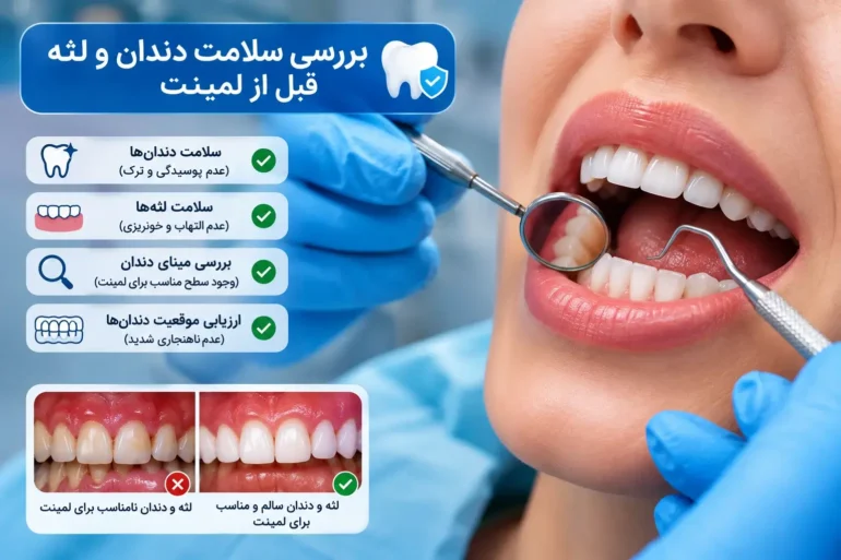 بررسی سلامت دندان و لثه قبل از لمینت دندان