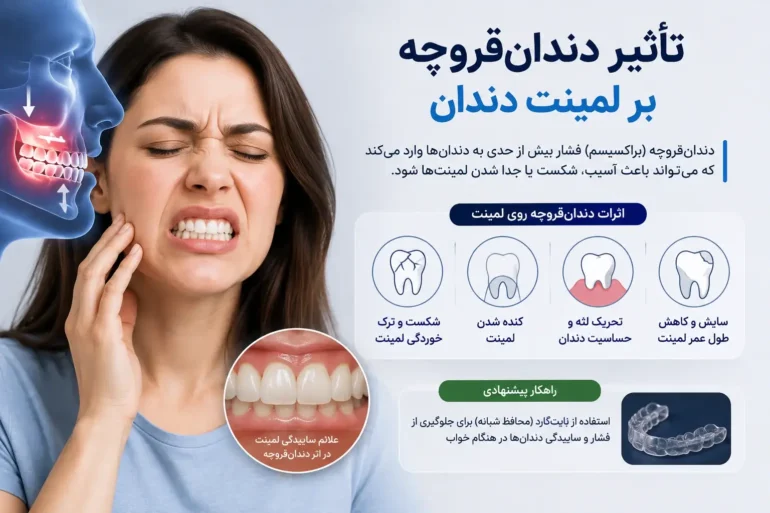 دندان قروچه و آسیب لمینت دندان