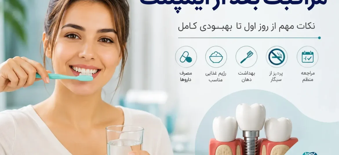 مراقبت بعد از ایمپلنت دندان