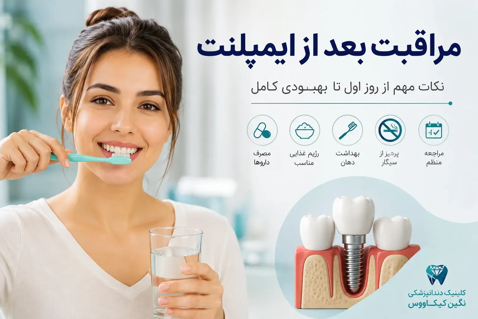 مراقبت بعد از ایمپلنت دندان