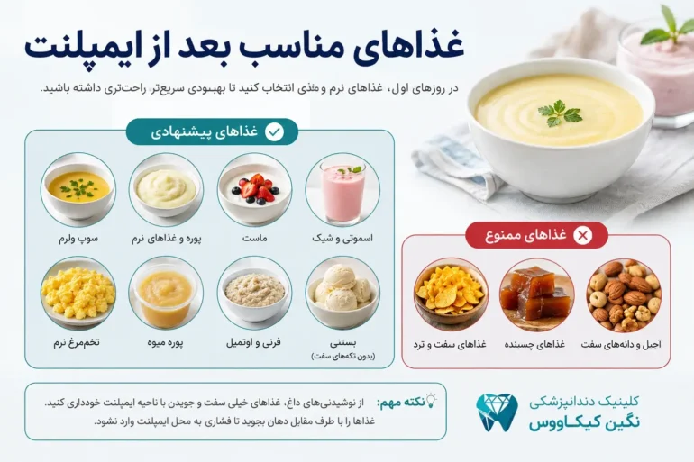 بعد از ایمپلنت چه چیزی بخوریم