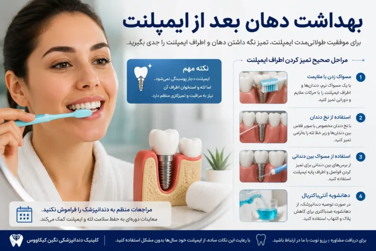 نحوه مراقبت و مسواک زدن بعد از ایمپلنت