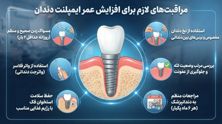 مراقبت از ایمپلنت دندان برای افزایش طول عمر آن