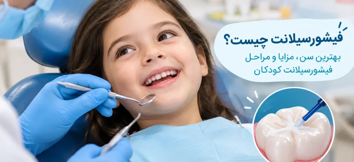 فیشورسیلانت دندان کودکان برای پیشگیری از پوسیدگی
