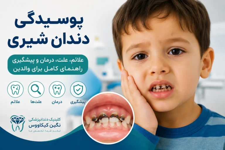 پوسیدگی دندان شیری در کودک