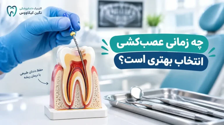 عصب‌کشی دندان برای حفظ دندان طبیعی