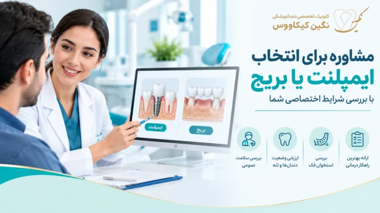 بررسی شرایط بیمار برای انتخاب ایمپلنت یا بریج دندان