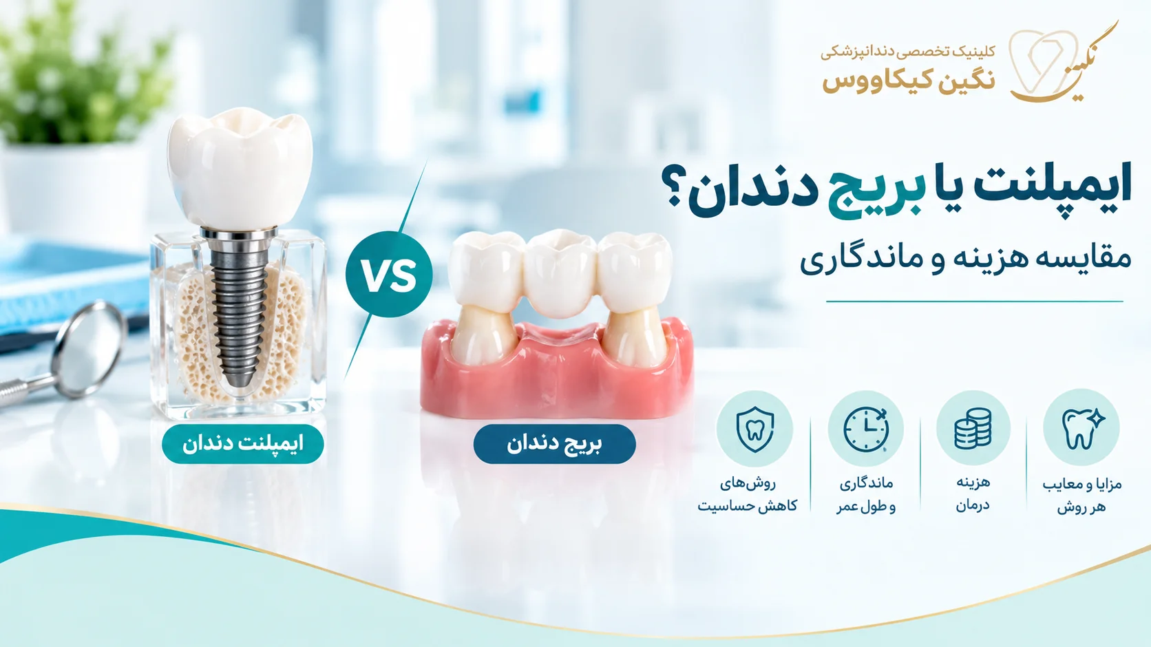 مقایسه ایمپلنت و بریج دندان برای جایگزینی دندان ازدسترفته