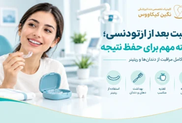 مراقبت بعد از ارتودنسی و استفاده از ریتینر برای حفظ نظم دندانها