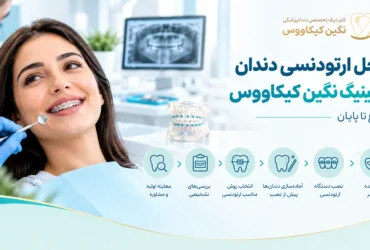 مراحل ارتودنسی دندان در کلینیک نگین کیکاووس
