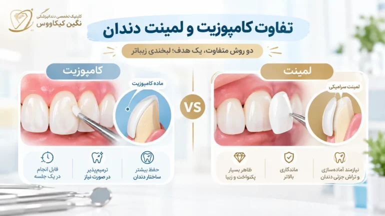 تفاوت کامپوزیت و لمینت از نظر نحوه قرارگیری روی دندان