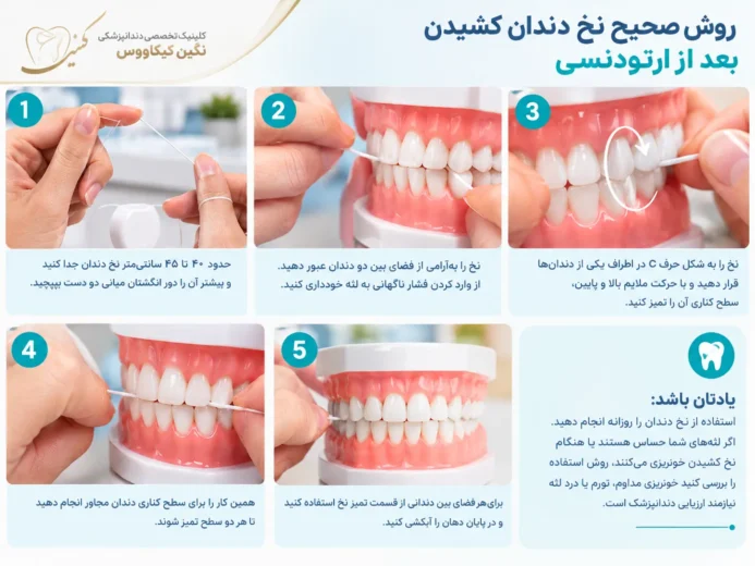 روش صحیح حرکت نخ دندان به شکل C بین دندان‌ها
