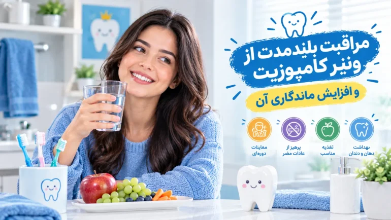 مراقبت بلندمدت از ونیر کامپوزیت و افزایش ماندگاری آن