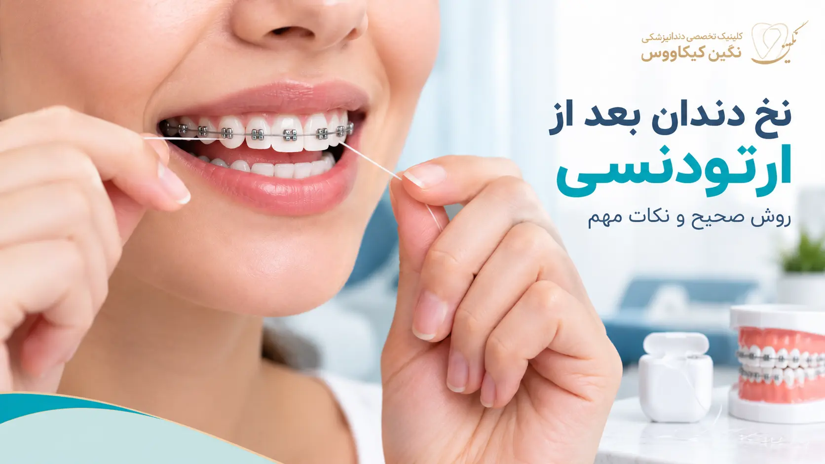 استفاده صحیح از نخ دندان بعد از ارتودنسی