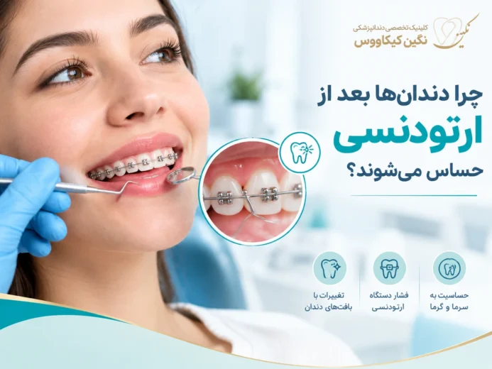 بررسی علت حساس شدن دندان‌ها در طول درمان ارتودنسی